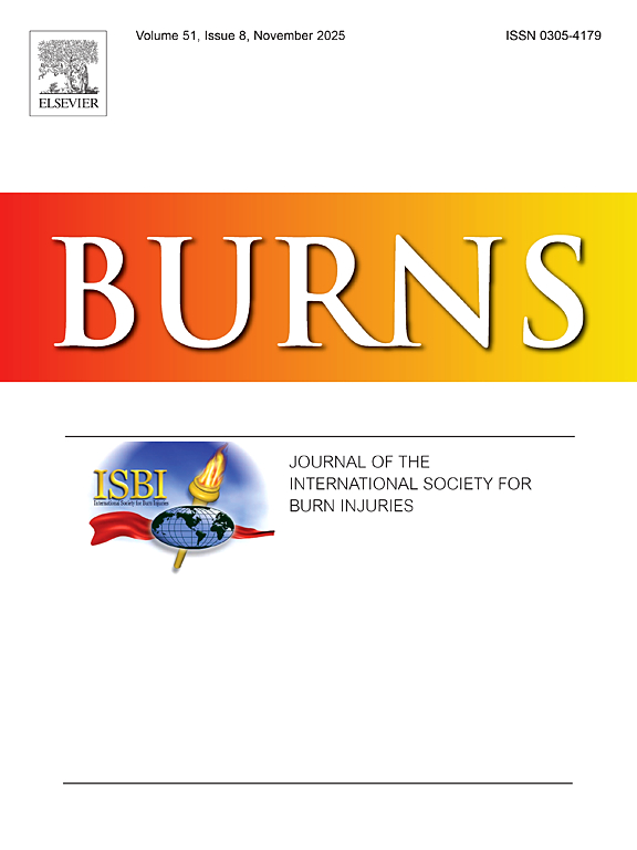 Burns cover image